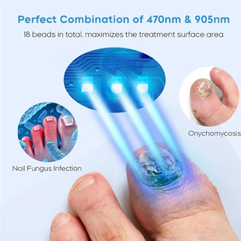 ABIT 2PCS Fungal Nail Laser Device Repair Fingernail Treatment Anti Fungus Infection Paronychia Onychomycosis Ingrown Toenail