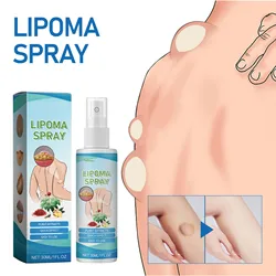 30ml Lipoma Removal Spray, Effective Pure Natural Herbal Lipoma Lump Removal Spray, Apply To Subcutaneous Lumps, Body Care Gift