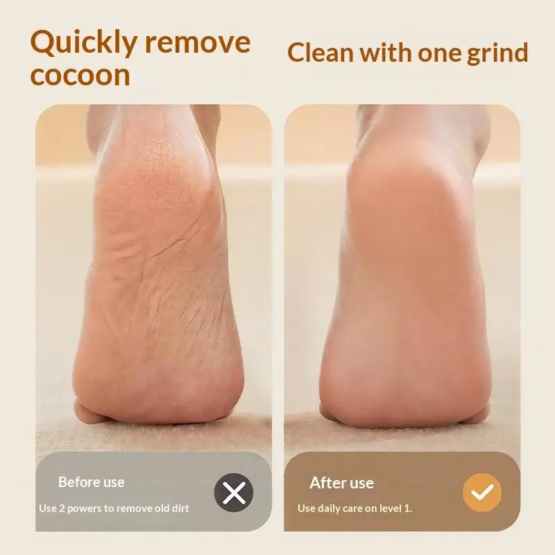 

USB Electric Foot File Callus Remover Pedicure Tool For Hard Cracked Dry Feet Heel Care Dead Skin Removal Home Foot Care