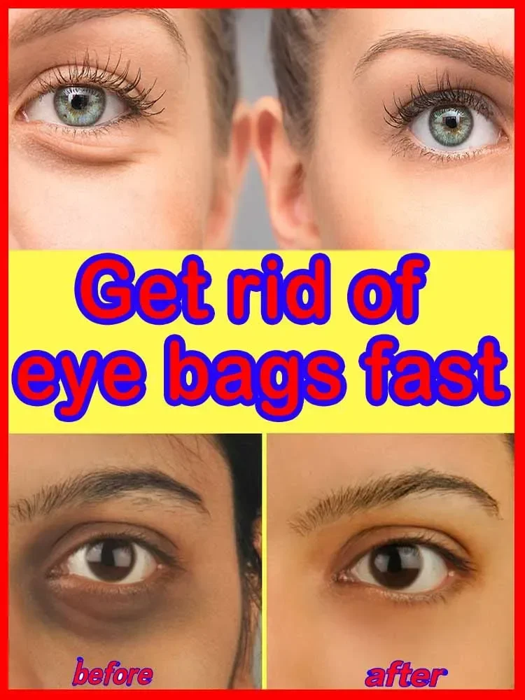 Eye Cream Improves Bags Dark Circles