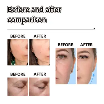 엘호 레티놀 페이스 크림 주름 제거, 기미 완화, 모공 축소, 보습, 주근깨 개선, 얼굴 피부 탄력 강화, 100ml (주야간 사용 가능) 6 best sales 모공 제거 크림 - №5