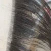 폐쇄 제작용 모발 주입기 5