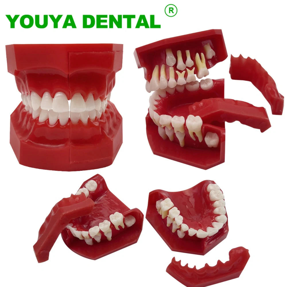 

Dental Model Children Teeth Primary Permanent Teeth Alternate Model Replacement Tooth Development Demonstration Model Dentistry