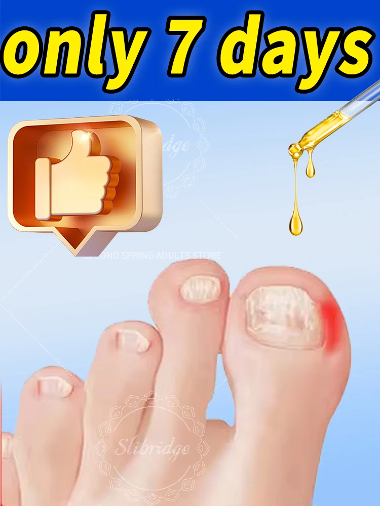 

manicure for bad Can in 7 days farewell