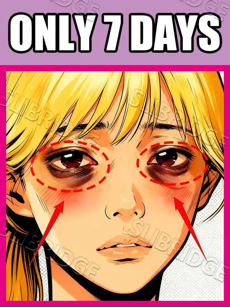 

Не отправляйте глаза мешки всегда будь «Спобедитель» для вашей усталости