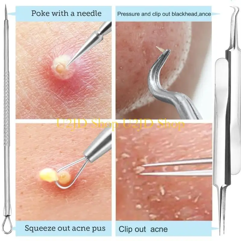 U2JD Blackhead Remover voor NES BACKOOD EXTRACTIES Gereedschap Puistje Squeezer Tool