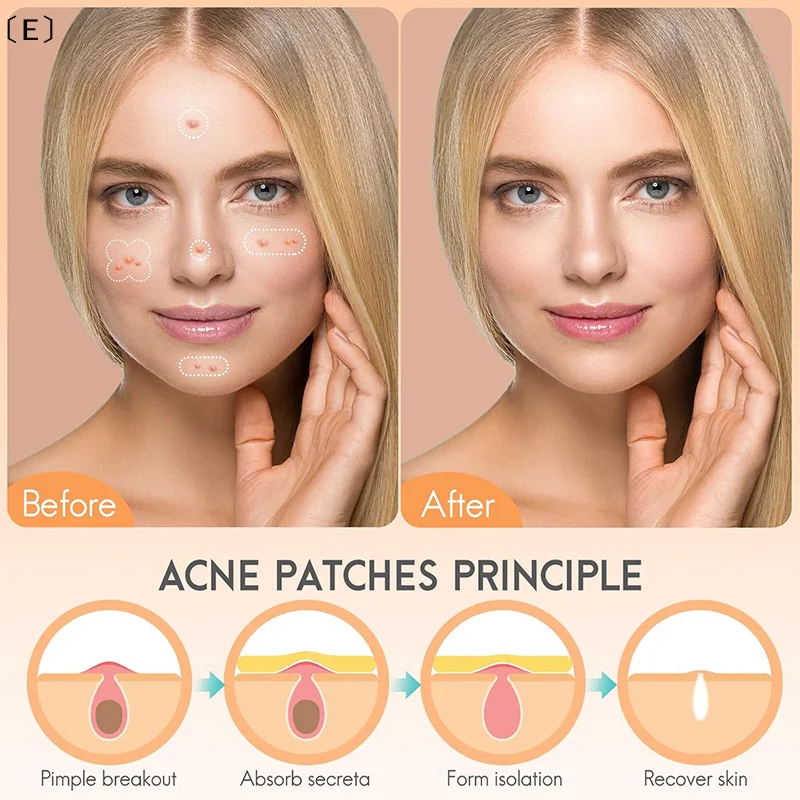 

〔E〕128PCS/SET Pimple Patch Acne Colorful Invisible Acne Removal Skin Care Stickers Concealer Face Spot Beauty〔Winter5〕