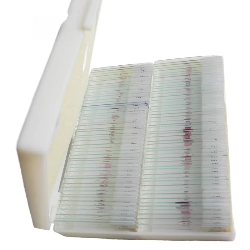 

Human Pathological Histology Tissue Microscope Prepared Slides Pathology Slides Medical Science Pathology
