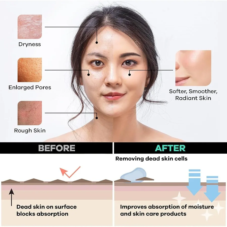 Luva esfoliante profunda para rosto, removedor de pele morta e seca para homens e mulheres, luvas esfoliantes para banho e uso seco, 1 pacote