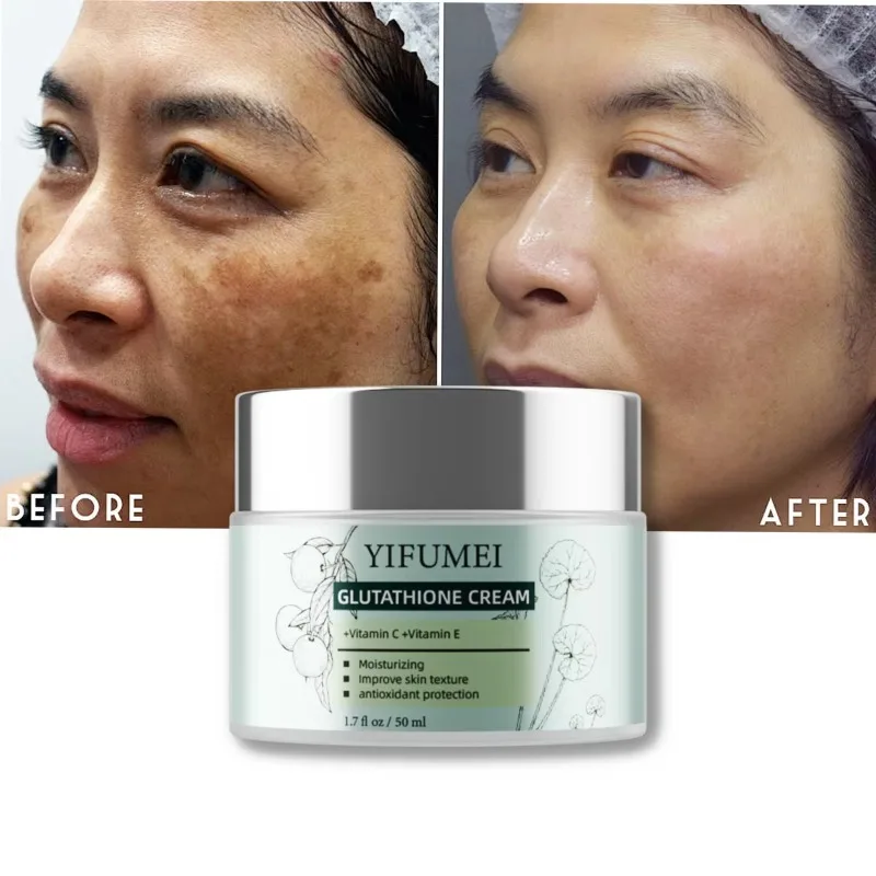 

Crown Diamond Lightening Dark Spot Treatment Anti Freckle Remover Vitamin C Glutathione Whitening Face Cream Women Skin Care