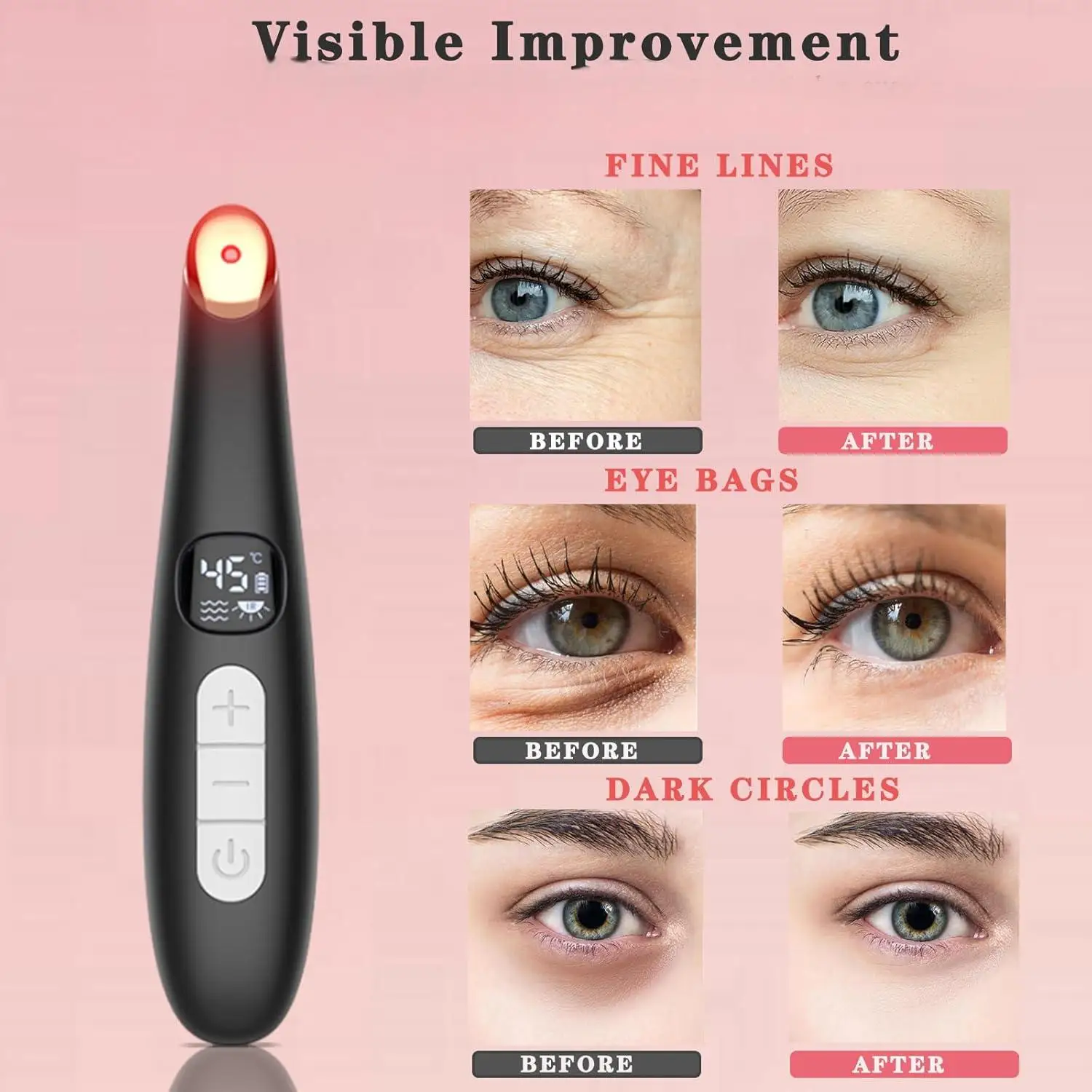 3-in-1-Augenliftstab, Schönheitsgerät, vibrierendes rotes Licht, 98 ° F bis 113 ° F LCD-Display-Augenmassagegerät für trockene Augen, dunkle Ringe, Schwellungen