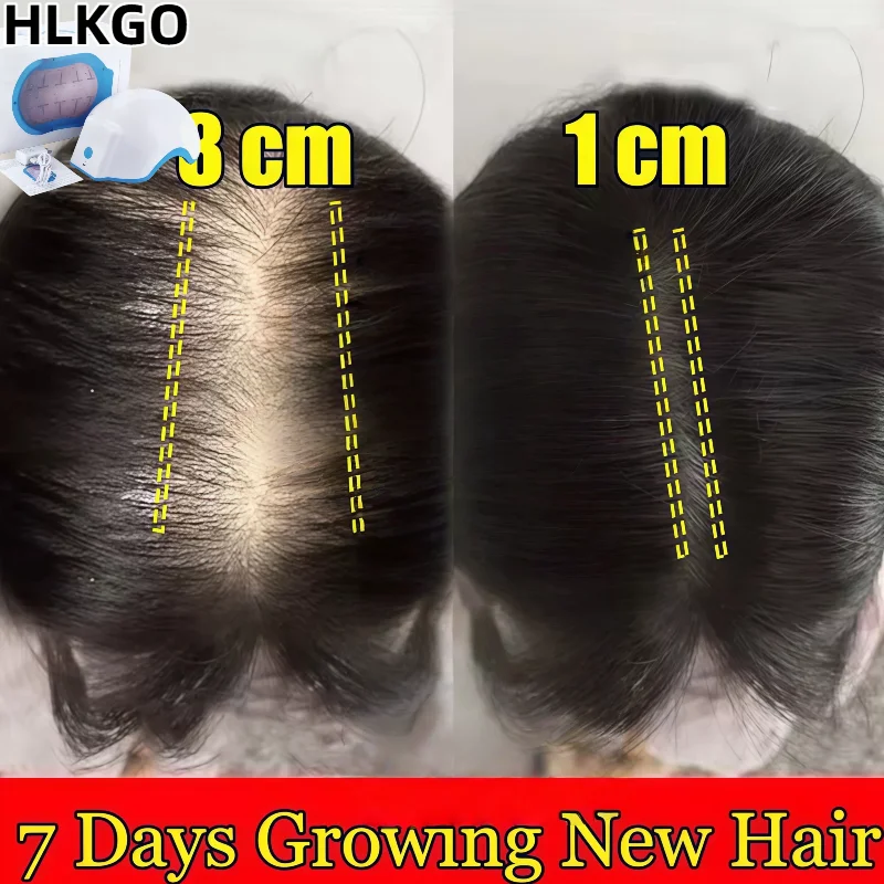 

665nm Near-infrared Hair Growth Cap 80Pcs, Red Light Therapy for Anti-Hair Loss, Reduces Oiliness and Strengthens Roots