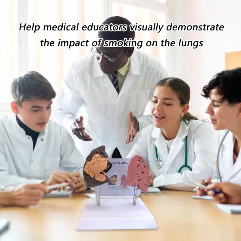 نفخة الرئة مقابل الرئة الصحية نموذج مقارن للتعليم السريري أداة تعليمية هيكل PVC الدائم F19E