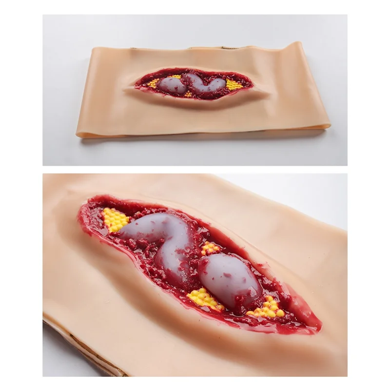 at82-entrenamiento-de-anatomia-abdominal-herida-de-anatomia-abdominal-para-ensenanza-y-entrenamiento-un-modelo-de-simulacion-de-emergencia-puede-realizar