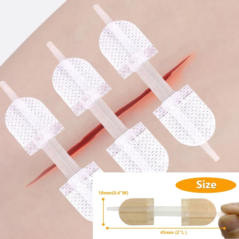 1pc 45*10mm Breathable Strap Zipper Wound Closure Patches Seamless Elastic Zip Sutures Bandages For Wound Care Braces Supports