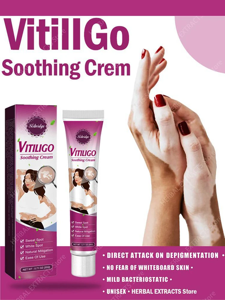 Vitiligo Cream