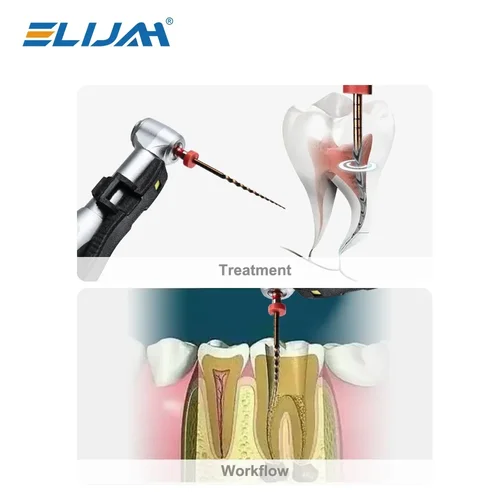 Imagen 2 del producto ELIJAH 6 uds limas de conducto radicular Dental agujas cónicas archivo endodoncia 25mm máquina NITI uso Material de conducto radicular instrumento de odontología