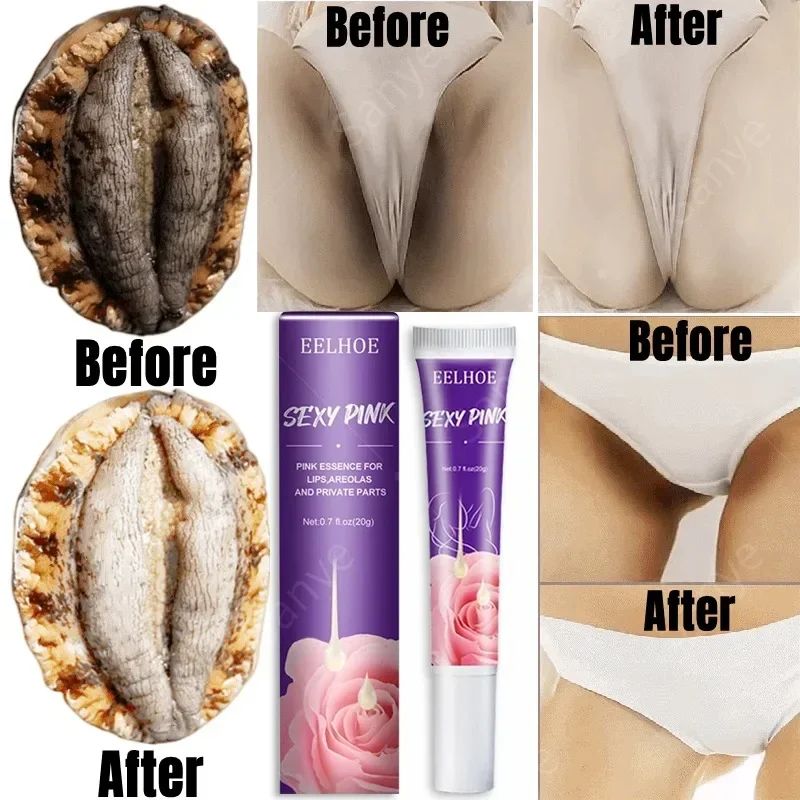 Women Skin Whitening Cream Remove Melanin Emulsion Brighten Private Parts Whiten Cream Inner Thigh Butt Underarm Bleaching Serum