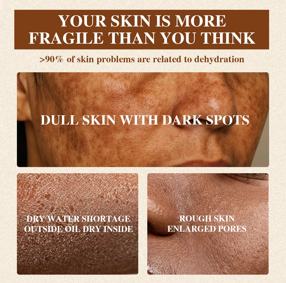 AILKE Dark Spot Corrector PLUS Cream, Organic Dark Spot Correction Facial Cream, Remove Stains, Age Spots, Sun Spots