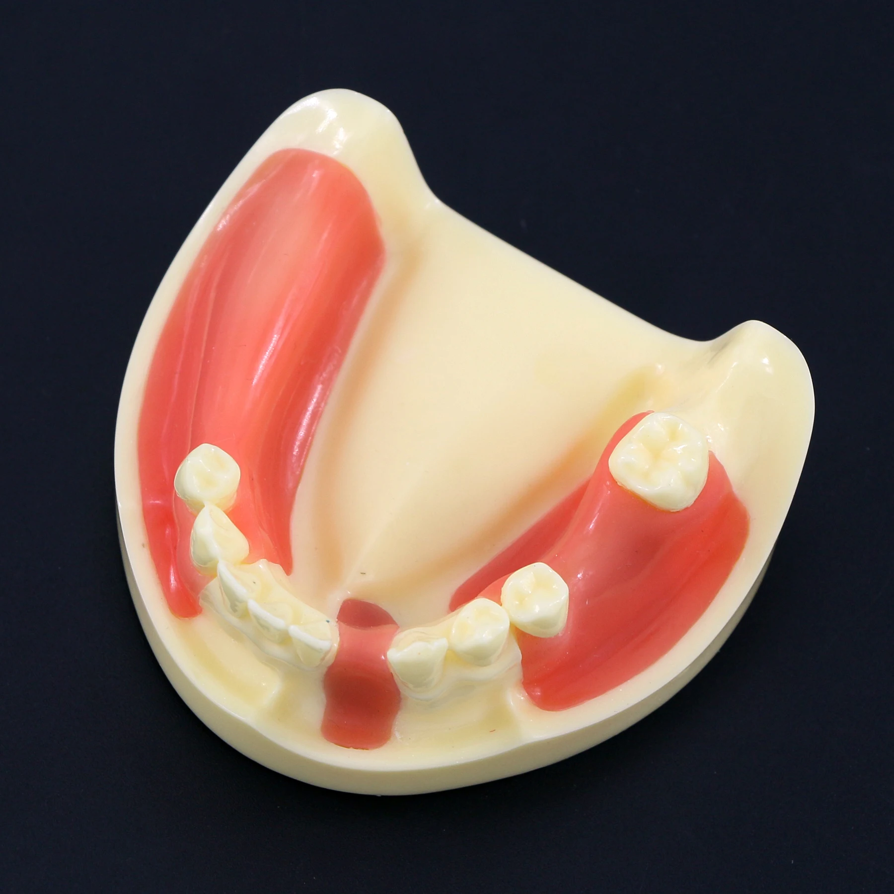 Dental Teeth Model Lower jaw with attached and removable gingiva flap and drilling practice Implant Teaching Demo Model