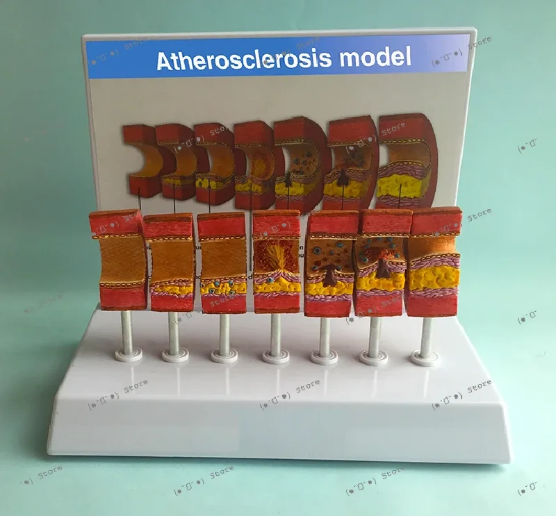 

модель сосудов, модель атеросклероза, модель тромбоэмболии, модель липидной окклюзии сосудов