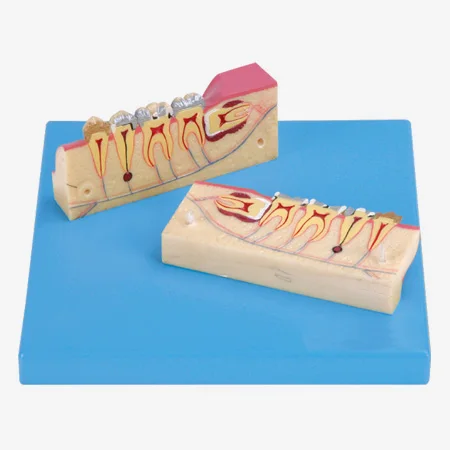 

Dissected Model of Teeth Tissue, Dental Care Model