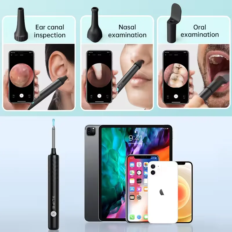 2024 New Arrival-Bebird ENT Observation Kit Set (Not Include Camera Device）For Visual Ear Canal / Nasal / Oral Inspection