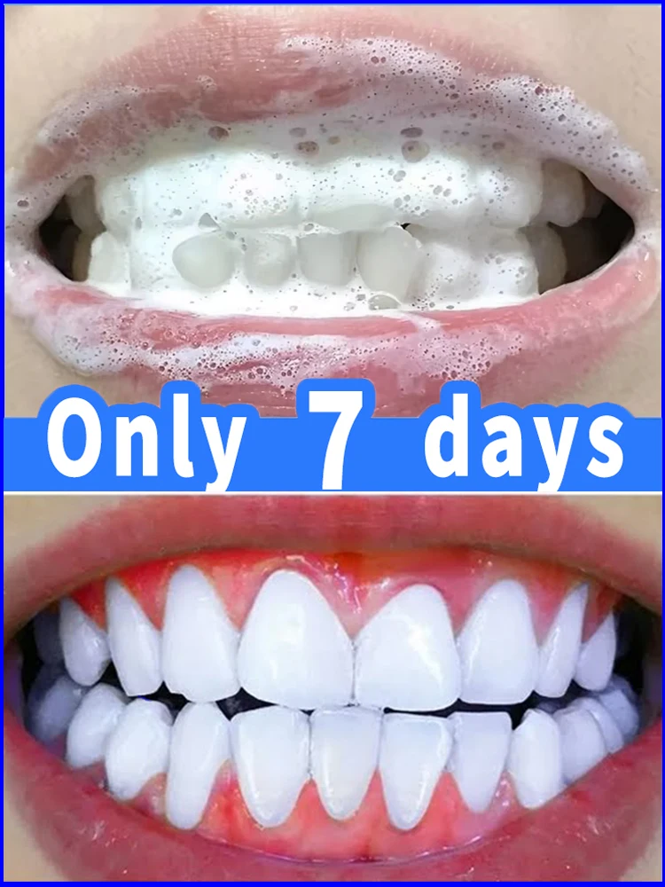 

Tartar removers dissolve tartar and remove stains in just 7 days