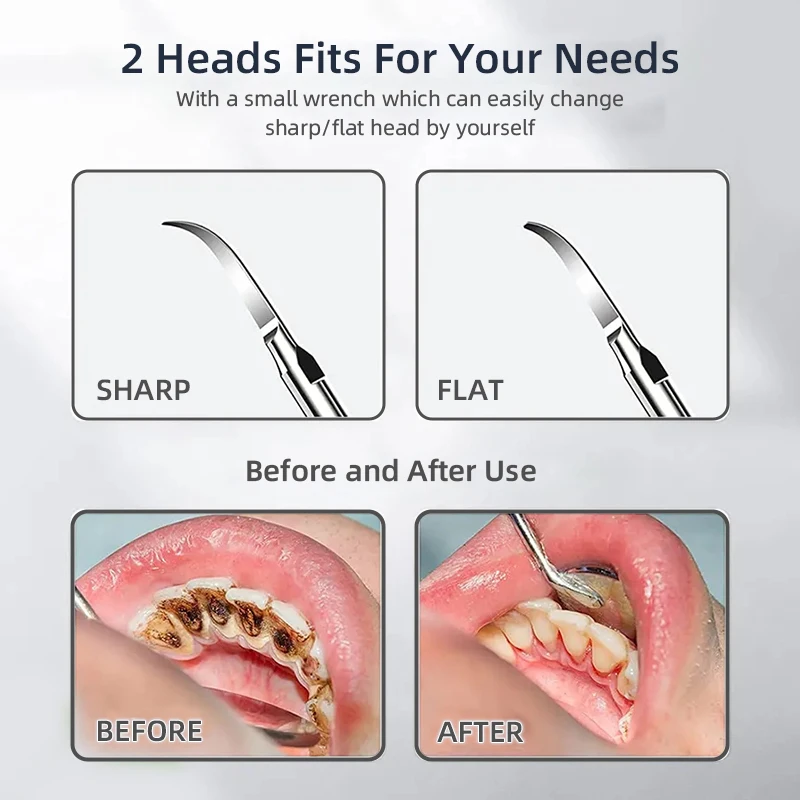Новый стиль, устройство для чистки зубов, средство для удаления зубного камня, звуковой электрический визуальный зубной скалер, средство для удаления налета для зубов