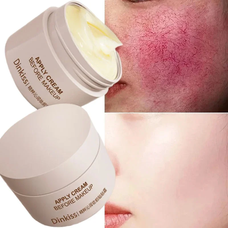 

Facial Redness Repair Cream Improve Sensitive Skin Dryness Moisturizer Hydrating Sooth Lotion Removal Rosacea Korean Cosmetics