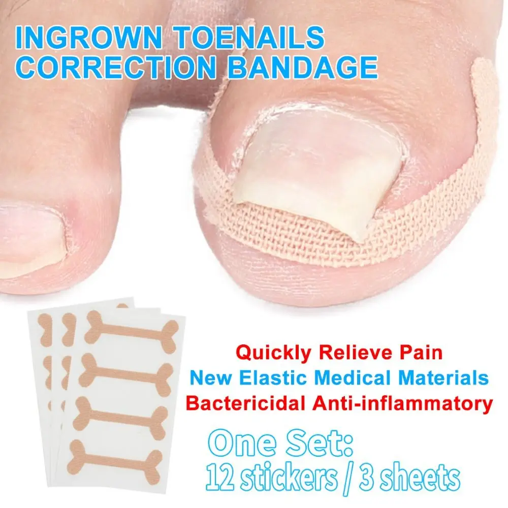 Pedicure patch Nail Toe Teratment unghie incarnite per decalcomanie dei piedi Paronychia Pedicure strumenti Pedicure Sticker strumento per la cura dei piedi