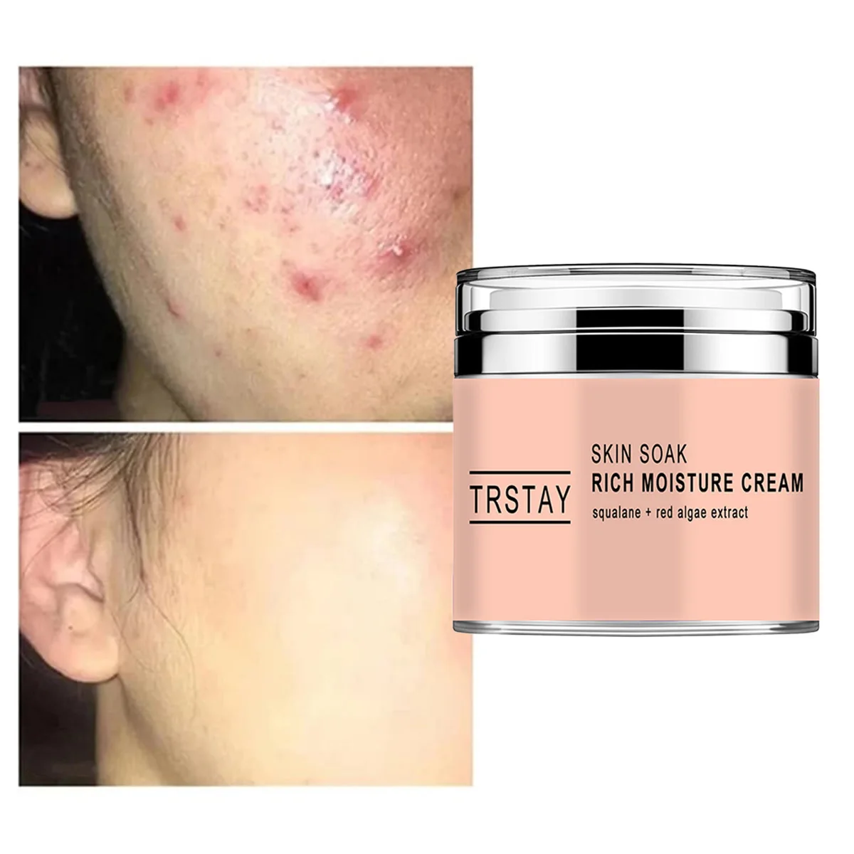 

TRSTAY Увлажняющий крем для замачивания кожи с экстрактом сквалана и красных водорослей для ухода за лицом
