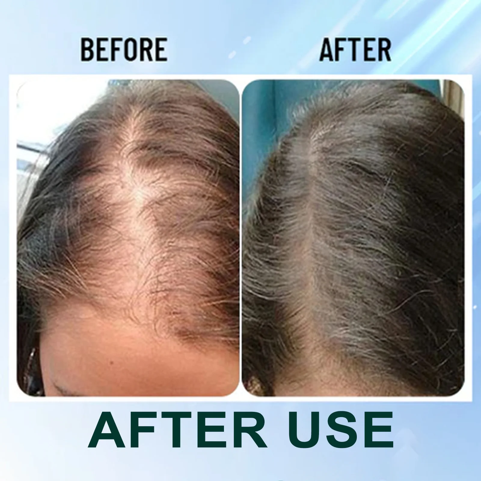 فرشاة تدليك فروة الرأس - فرشاة سميكة بشعيرات الخنزير لتحفيز الجذور ومكافحة تساقط الشعر والعناية بتكثيف الشعر #5