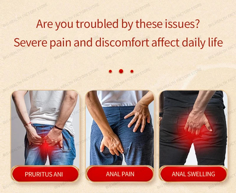 Thaise anale jeukcrème kalmeert anale ongemak, anale jeuk, jeuk in geslachtsdelen, ongemak voor roodheid en zwelling, externe verzorging en gezondheidszorgcrème