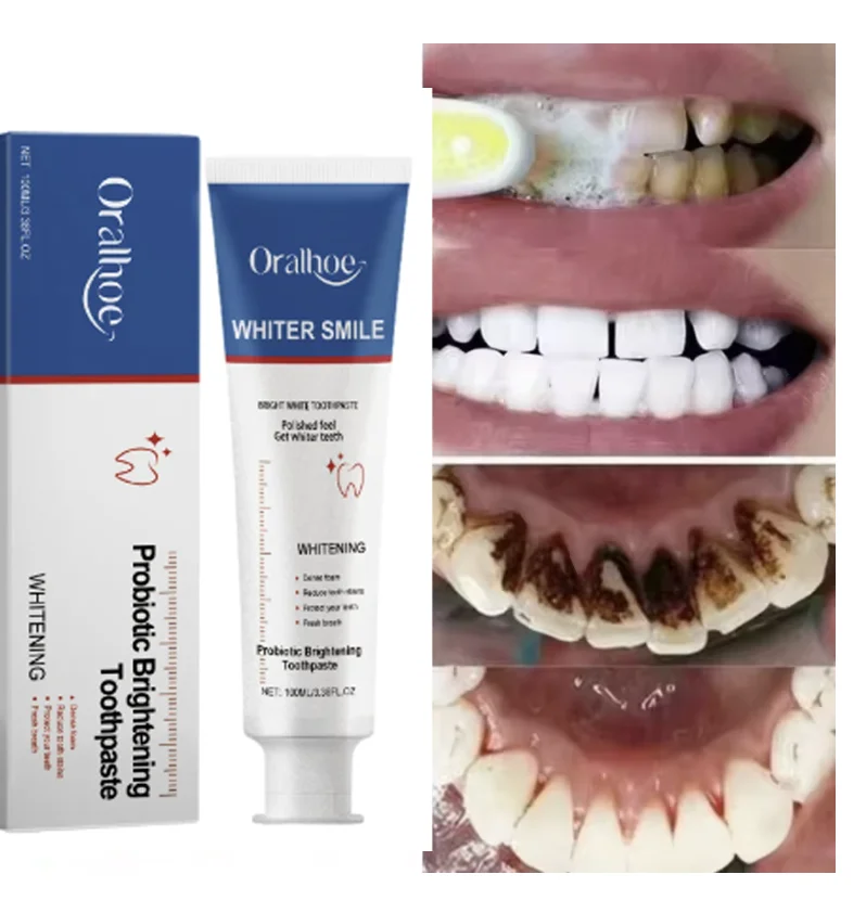 

Probiotic Whitening Toothpaste - Deeply Cleanse Yellow Stains And Dental Plaque, Repair Teeth, Whiten Enamel And Refresh Breath