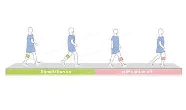 Sistema di caduta del piede Stroke Patient G4 -2001E FES Walk Trainer