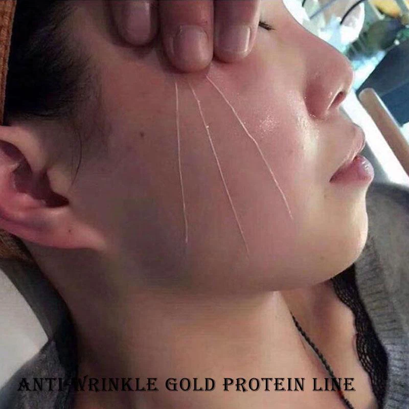 New Face Filler Absorbable Collagen Protein Thread Face Lift Plump Silk Fibroin Line Carving Anti Aging Essence Do Wholesale