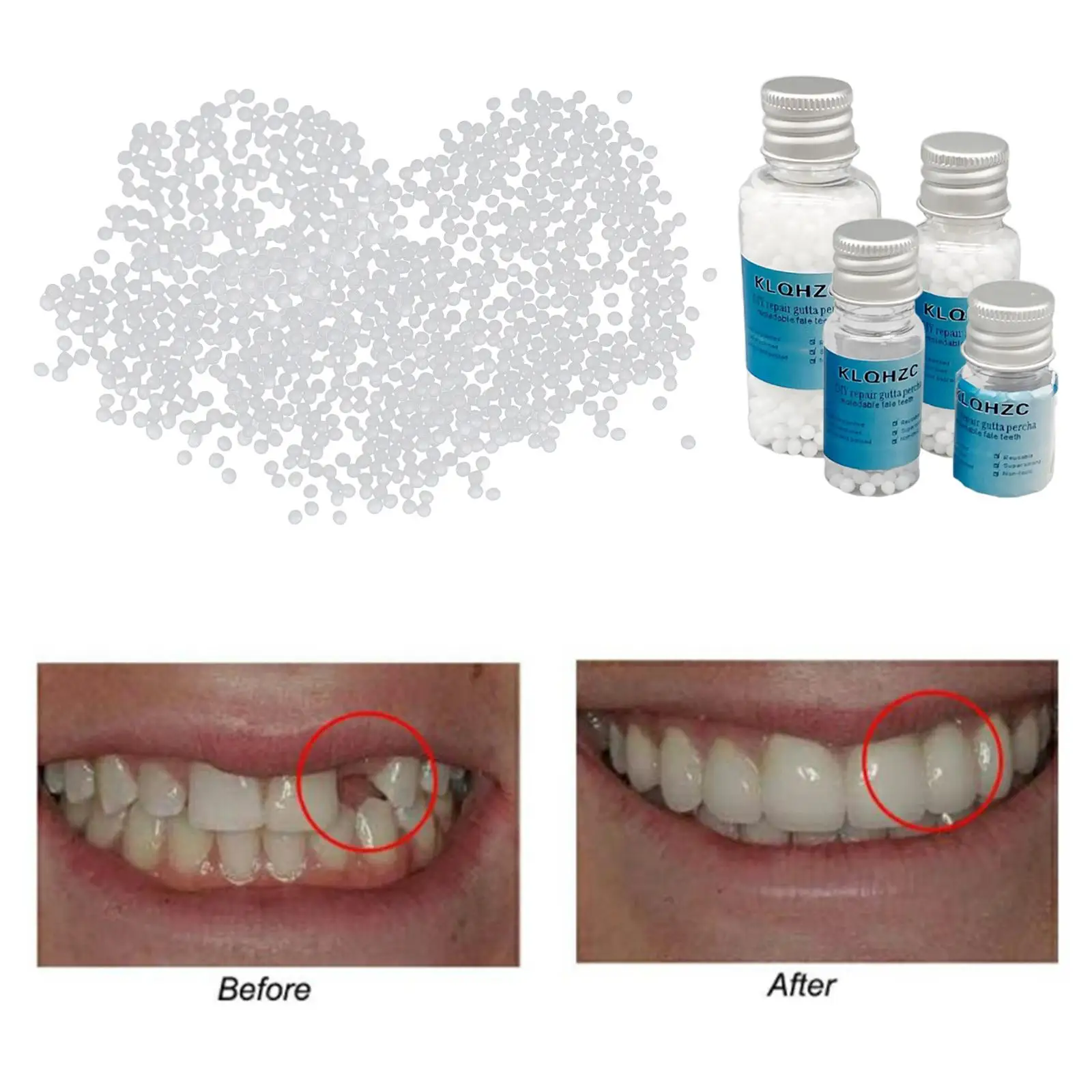 Thermal Beads Teeth Veneers Temporary Teeth Repair Kit Thermal Beads