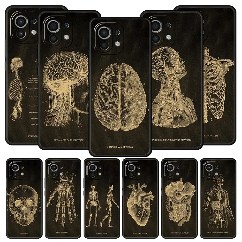 Skeleton Chalkboard Body Heart Phone Case For Xiaomi 14 13T 12T Pro 12 13 11 Mi Note 10 Lite 10T 5G 11X Pro 11T 11i 9T Cover