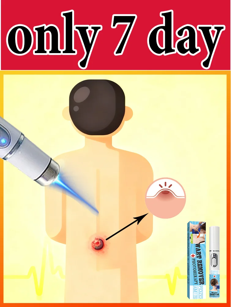 

ʙʟᴜᴇ ʟɪɢʜᴛ ᴘᴇɴ sᴏʟᴠᴇ ᴡᴀʀᴛs, ʜᴏᴛ sᴀʟᴇ ᴡᴀʀᴛ ᴄᴀʀᴇ ᴛᴏᴏʟs