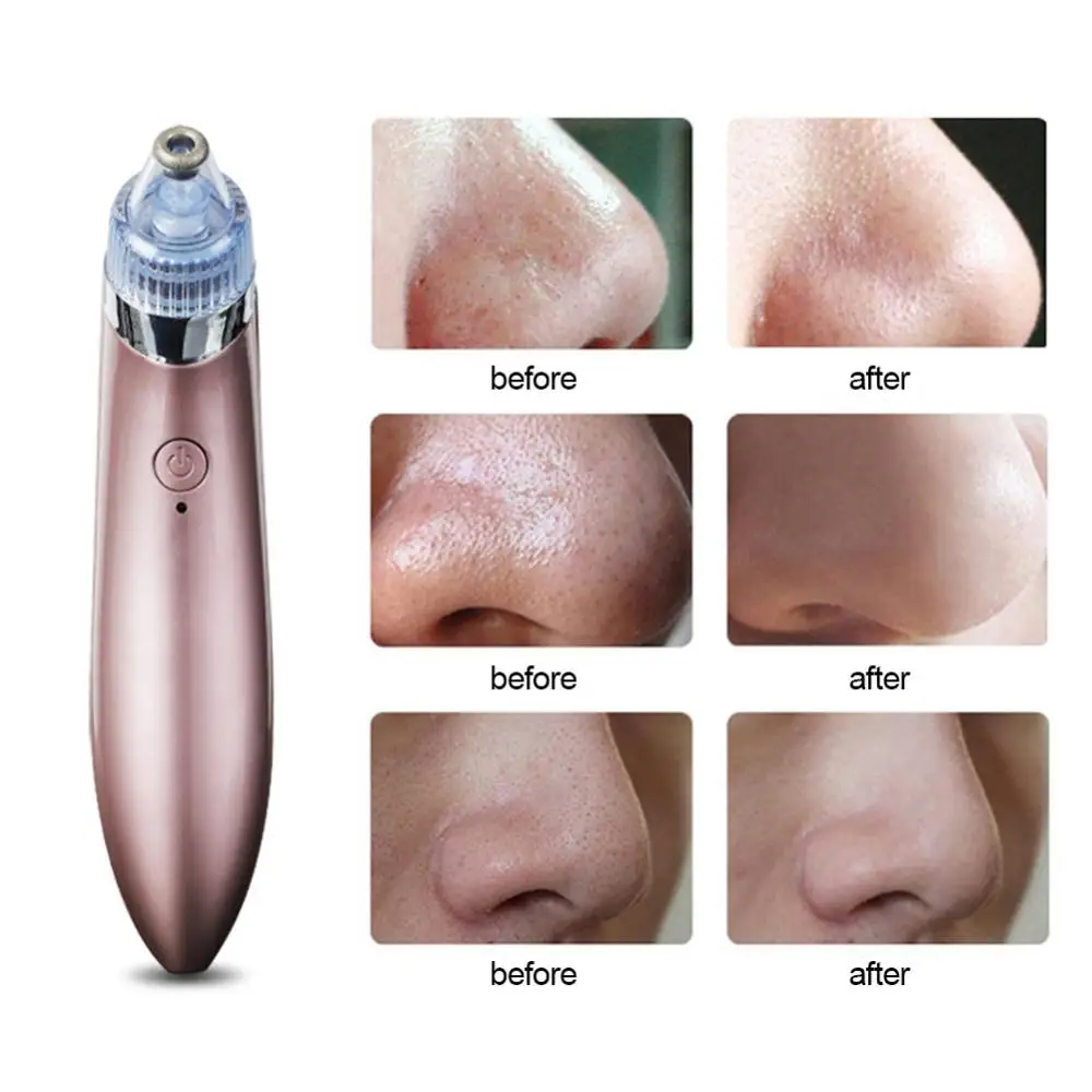 Cleaner Blackhead Remover Beauty Instrument Pore Vacuum Acne Pimple Black Spot Suction Electric Facial Skincare Exfoliating