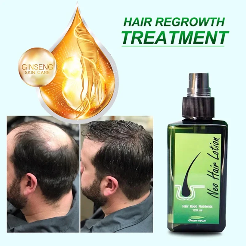 2023 Novo 100% Original Paradise Neo Hair Lotion Tailândia Hair Growth Oil Scalp Tratamento para Mulheres Homens Anti-Hair Loss Spray