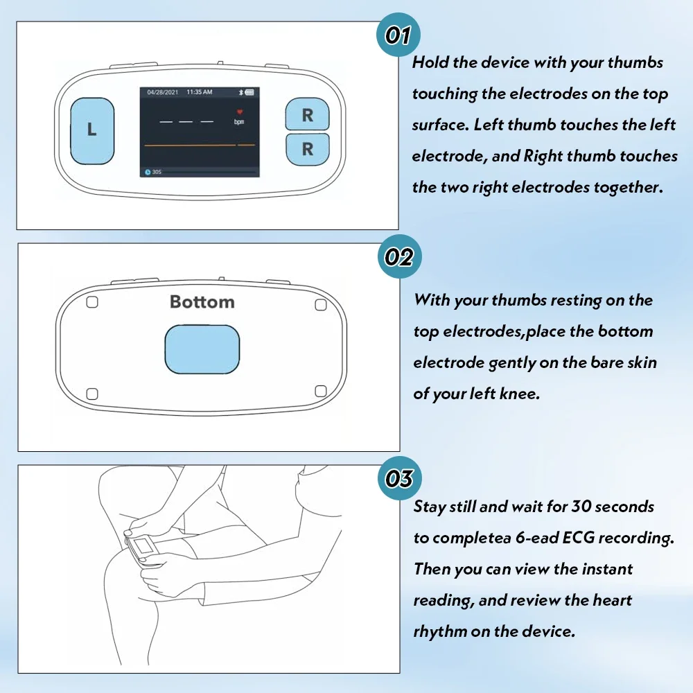 Contec PM20 Digital Portable ECG Monitor 6 Lead EKG Machine Bluetooth Mobile App