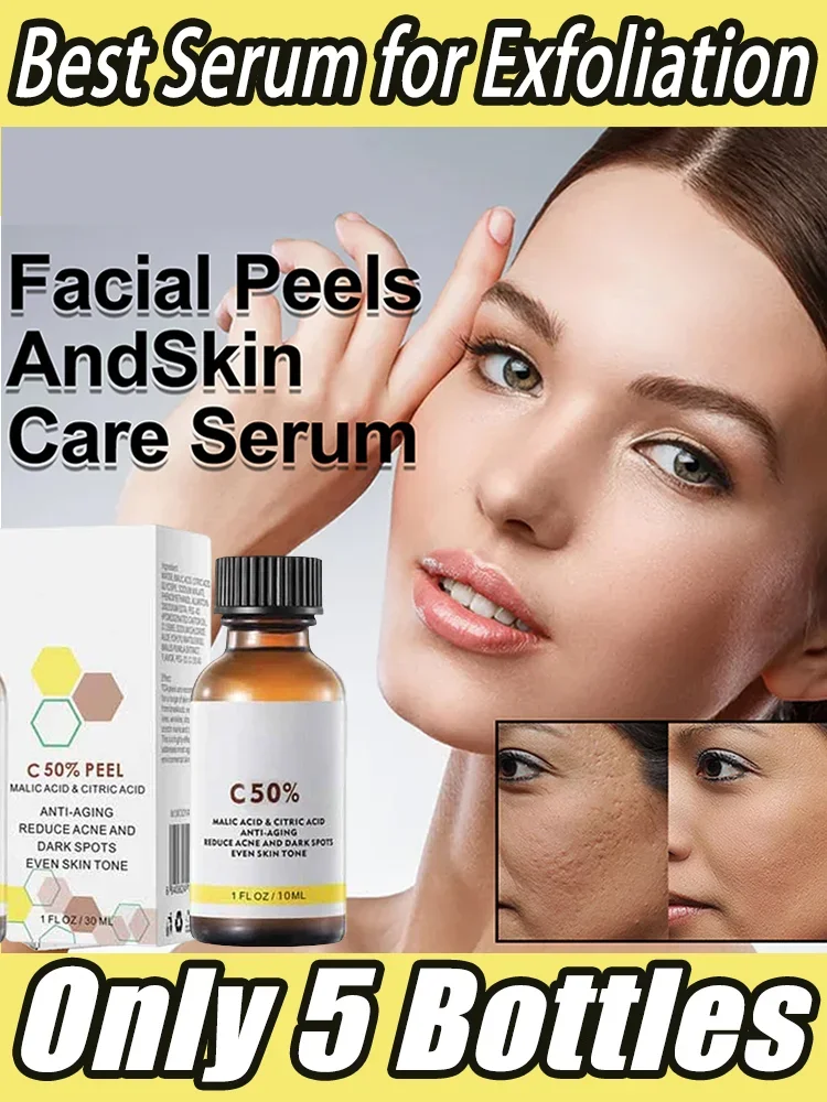 

High Quality 50% Chemical Exfoliating Peel Tca Peel Acid Skin Superforce Pigmentation Lightening Melanin Acne Beauty care