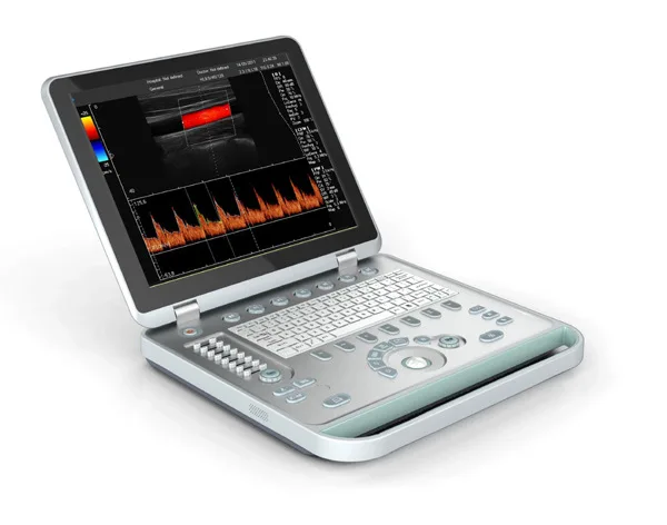 High Quality 15-inch Color Ultrasound Machine With Convex Array Probes For Medical