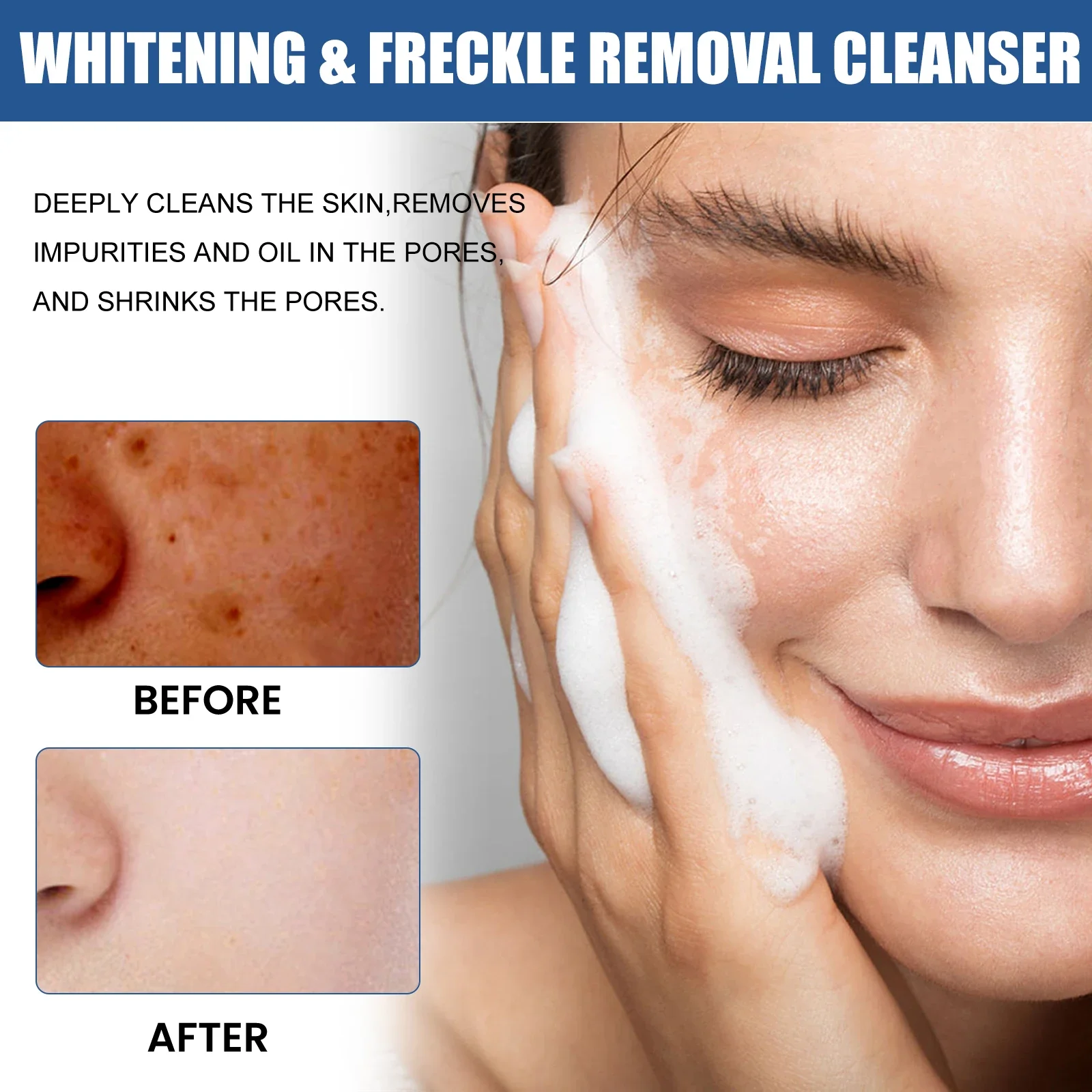 Whitening & Freckle Removal Cleanser Deeply Cleanse Pores Dirt Brighten Nourish Reduce Pigmentation Control Oil Facial Cleanser