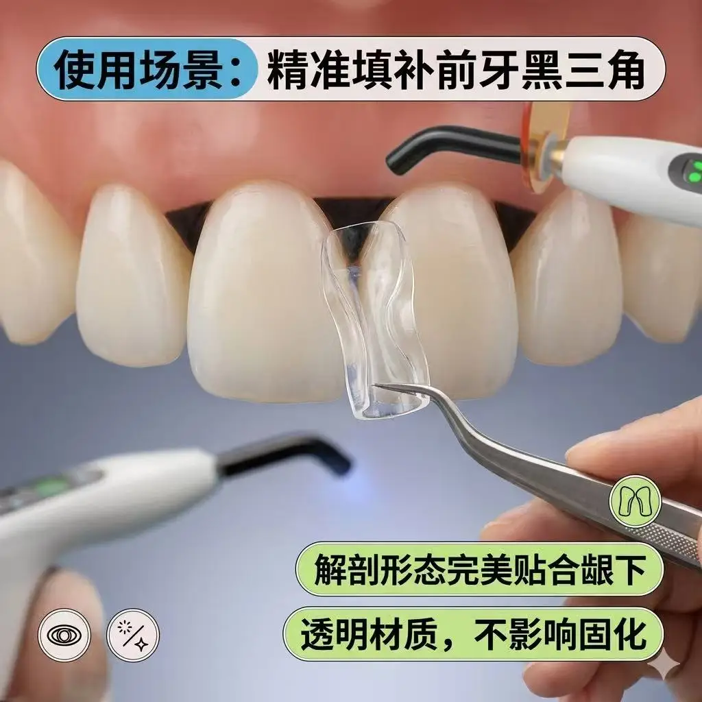 Transparent Dental Mylar Matrix Bands Resin Filling Forms for Anterior Tooth Gap Black‑Triangle Restoration Training Practice