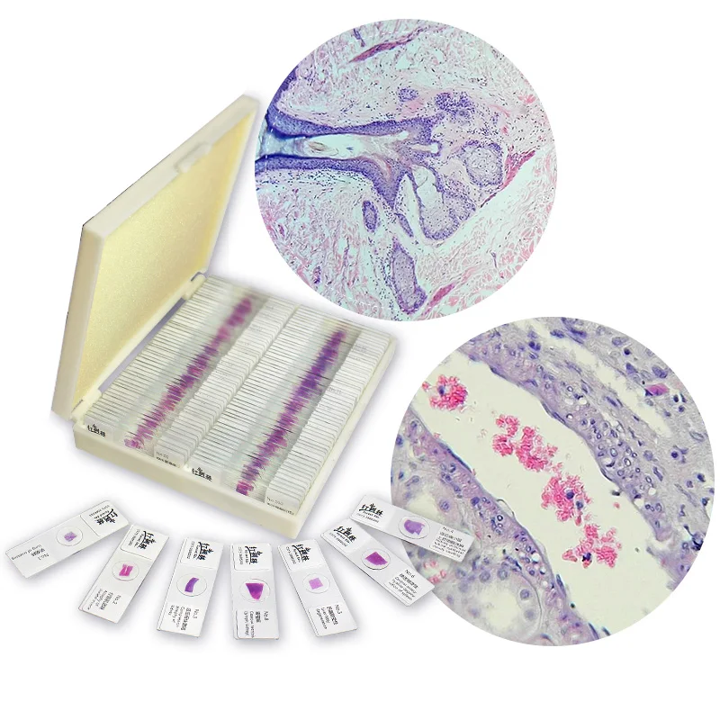 100 PCS Professional Prepared Human Pathological Slice Microscope Slides for Medical University Science Biology Research