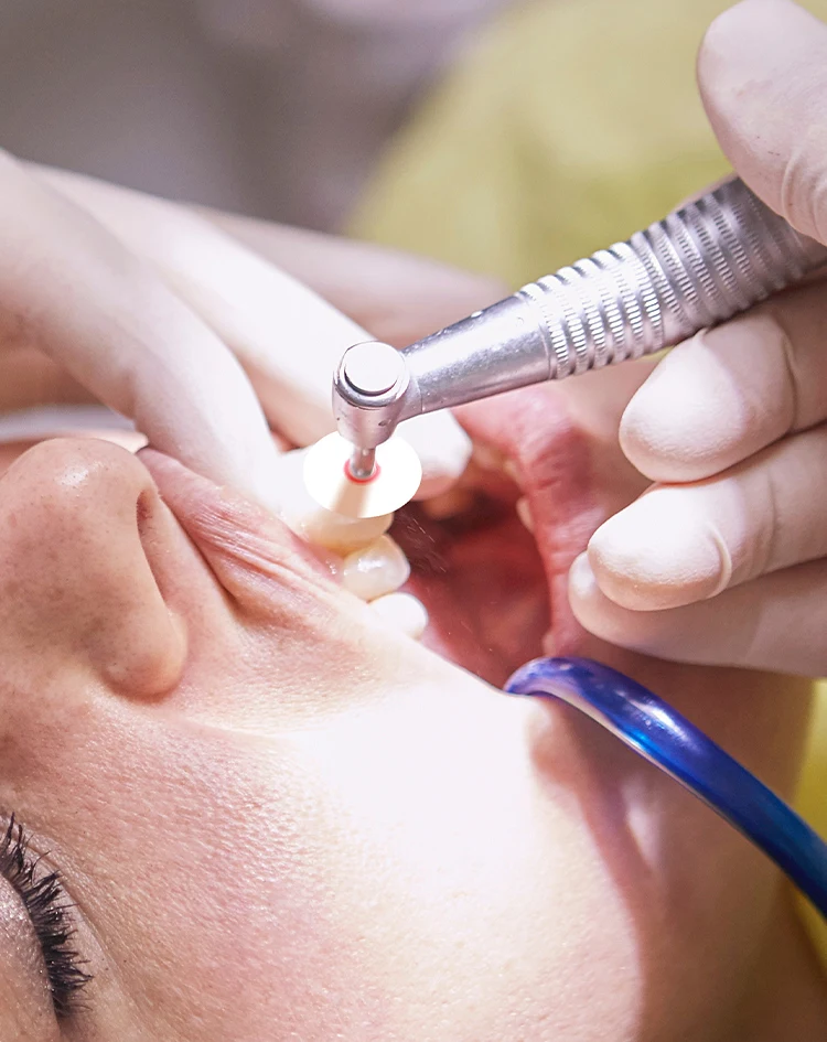 3 Boxen AZDENT Dental-Polierscheiben, transluzent, Durchmesser 12,5 mm, mit Aluminiumoxidpartikeln, 1 Stück Dorn, Zahnmedizin-Werkzeug – Detail 8