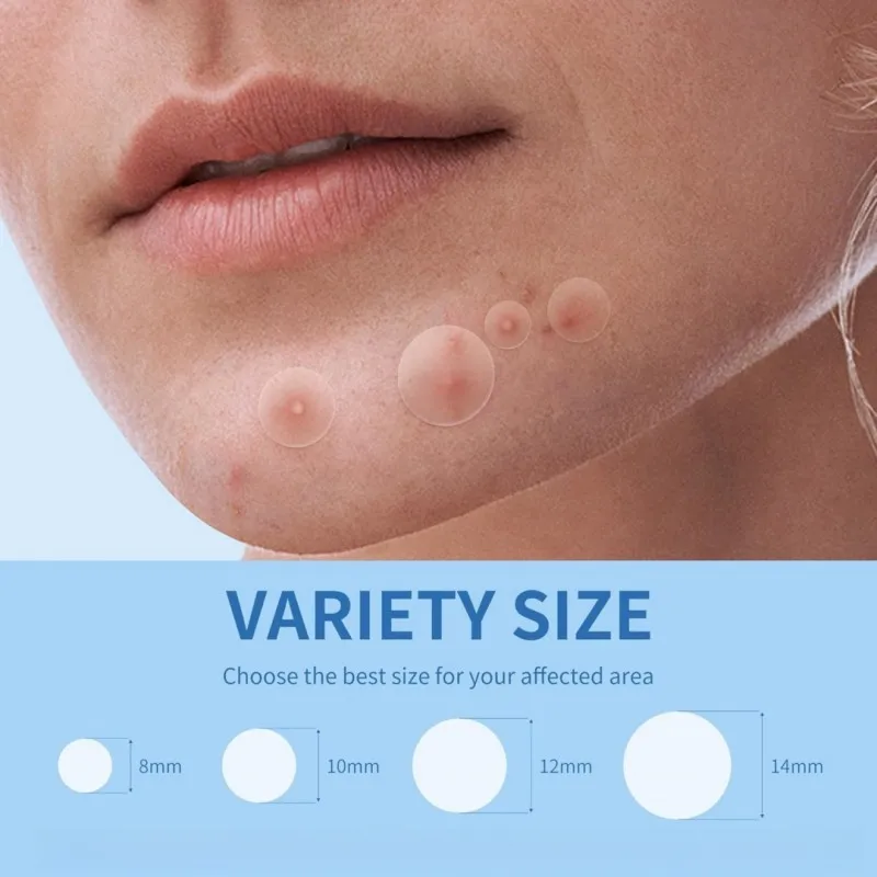 400 قطعة من رقع حب الشباب للوجه، رقع كونسيلر، رقع البثور، هيدروجيل رفيع للغاية وغير مرئي وجيد التهوية #2